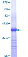 12.5% SDS-PAGE Stained with Coomassie Blue.